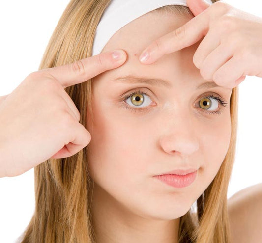 Mascarilla para combatir el acné